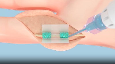 Coaptium Picture 3