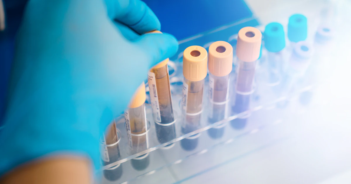 Stratify Test Quest, MD Anderson to Develop Multi-cancer Stratification Blood Test ...