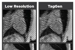 Low Res 25 0812 Sm Heart Mri Scan Comparison 03