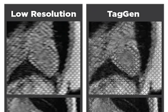 Low Res 25 0812 Sm Heart Mri Scan Comparison 03
