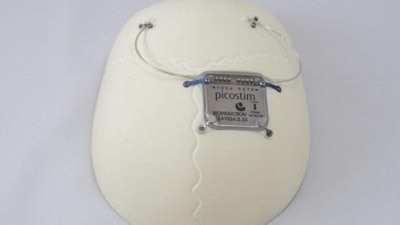 The Picostim-DyNeuMo research system, made by UK company Amber Therapeutics, is an adaptive neurostimulator seated in the skull with two electrodes placed in targeted brain circuits to sense physiological signals and provide stimulation.