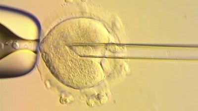 This image from video provided by the Newcastle Fertility Centre shows a nuclear genome from an egg carrying a mitochondrial DNA mutation being inserted into an egg donated by an unaffected woman.