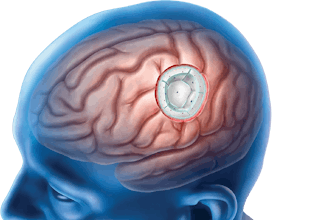 Illustration Opt 3840