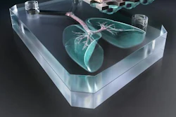 Low Res Lung Chips