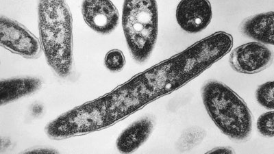 This 1978 electron microscope image made available by the Centers for Disease Control and Prevention shows Legionella pneumophila bacteria which are responsible for causing the pneumonic disease Legionnaires' disease.
