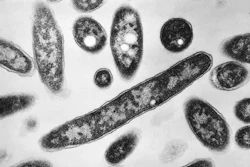 This 1978 electron microscope image made available by the Centers for Disease Control and Prevention shows Legionella pneumophila bacteria which are responsible for causing the pneumonic disease Legionnaires' disease.