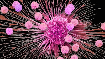 Cgt Campaign Modality Visual Car T Cell Therapy Sem Spl 1407 Download En Data