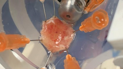 Capsule during scanning of a human esophageal resection.