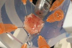 Capsule during scanning of a human esophageal resection.