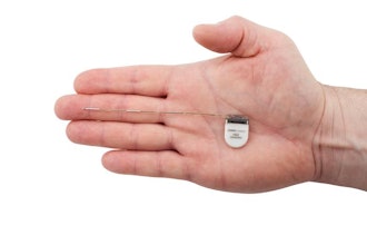 Low Res Implant In Hand