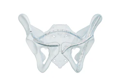 Five Curva Fix Implants In Pelvis