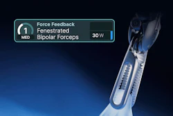 Force Gauge To Use For Pr And Social