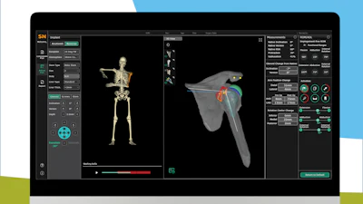 Coriograph For Shoulder Press Release Social Media Campaign3 Instagram