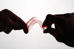Fp3 D Partial Denture