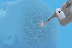 Monteris Medical and Symphony Robotics have partnered to evolve surgical precision with the use of advanced robotics for brain ablation surgery.