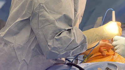 Dr. Mariana Chavez, who is a surgeon with The Surgical Clinic, a division of Tennessee Oncology, and specializes in hepatopancreaticobiliary surgery, is performing the procedure at Ascension Saint Thomas Midtown and Tristar Centennial Medical Center.