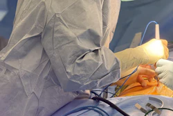 Dr. Mariana Chavez, who is a surgeon with The Surgical Clinic, a division of Tennessee Oncology, and specializes in hepatopancreaticobiliary surgery, is performing the procedure at Ascension Saint Thomas Midtown and Tristar Centennial Medical Center.