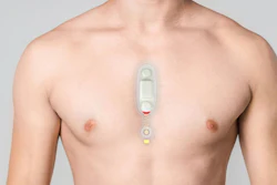 ECG sensor attached to the chest.