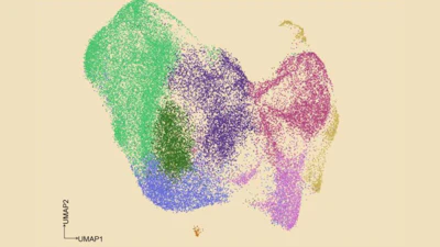 A UMAP graphical depiction of 45,963 cancer cells from patients whose chronic lymphocytic leukemia has transformed into a more aggressive type. The different colors represent different cell states (e.g., light green represents an inflammatory state, hot pink represents proliferating). GoT-Multi linked these cell states with their mutational status to reveal the commonalities in gene activity that lead to treatment resistance.