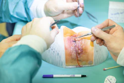 Addion Dap Eyelid Image 2