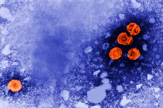 Microscopic view of orange spherical virus particles on blue textured background