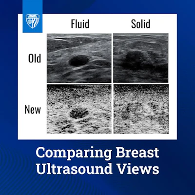Low Res 25 12 02 Media Release Graphic New Tech In Breast Ultrasounds V2