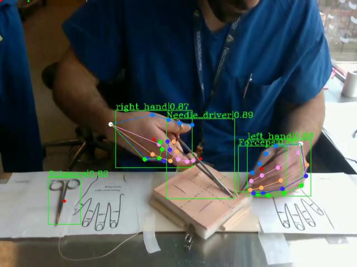 The team trained their model by tracking the hand movements of expert surgeons as they closed incisions.