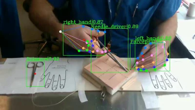 The team trained their model by tracking the hand movements of expert surgeons as they closed incisions.
