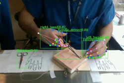The team trained their model by tracking the hand movements of expert surgeons as they closed incisions.