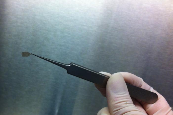 Researchers at Keck Medicine of USC are launching a phase 2b clinical trial examining if stem cells bioengineered to replace failing cells in the retina damaged by macular degeneration could restore eyesight.