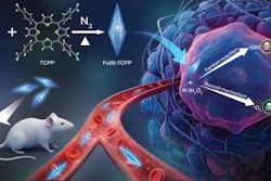 Scientists at Oregon State University have developed a new nanomaterial that triggers a pair of chemical reactions inside cancer cells, killing the cells via oxidative stress while leaving healthy tissues alone. It's an iron-based metal-organic framework that in cancer cells catalyzes the production of radical hydroxyls and singlet oxygen.