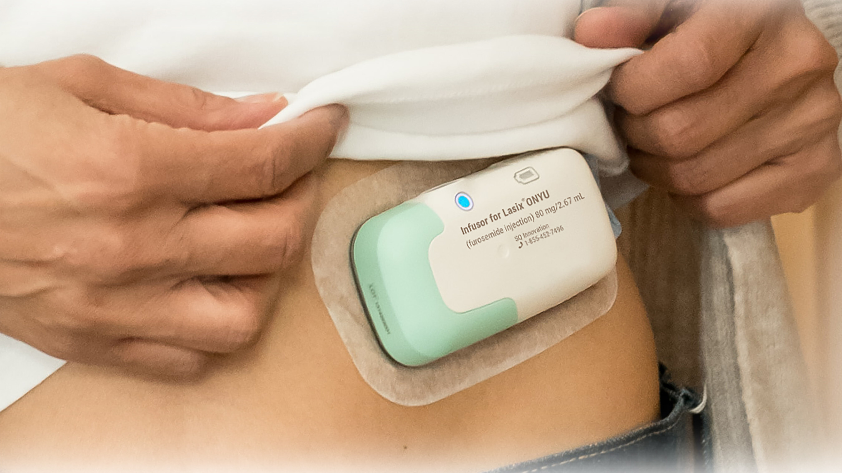 Lasix Onyu Treatment For Edema In Chronic Heart Failure