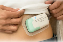 Lasix Onyu Treatment For Edema In Chronic Heart Failure
