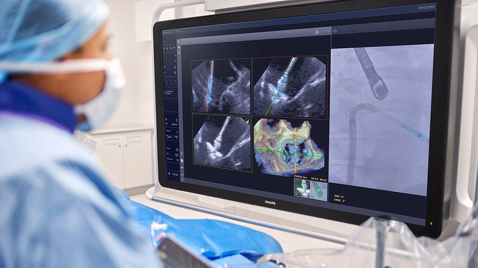 Header Physician Using Deviceguide With Echonavigator 5