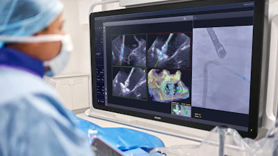 Header Physician Using Deviceguide With Echonavigator 5