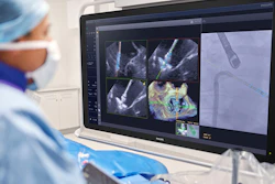 Header Physician Using Deviceguide With Echonavigator 5
