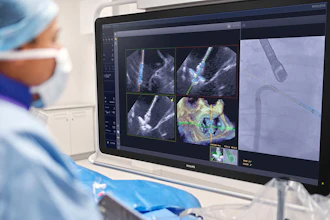 Header Physician Using Deviceguide With Echonavigator 5