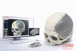 Photo Product Image Of Easymade Ti