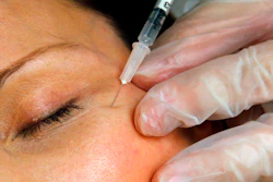 A patient receives a Botox injection at a clinic in Arlington, Va., on June 5, 2009.