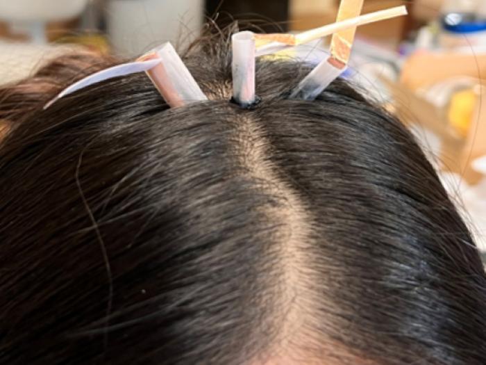 EEG electrodes are placed through hair during testing of a biogel designed by Penn State researchers to improve contact with the scalp for wearable brain-monitoring systems. The reusable material softens with gentle heat, reaches the skin and gels again as it cools.