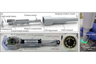 The researchers’ design: a wireless, hand-held probe that can differentiate between healthy and cancerous tissue.