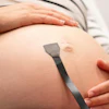 A new wearable ultrasound patch could provide continuous monitoring of the fetus and umbilical cord during pregnancy.