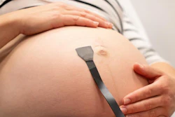 A new wearable ultrasound patch could provide continuous monitoring of the fetus and umbilical cord during pregnancy.
