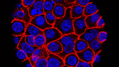This undated microscope image from USC via the NIH shows pancreatic cancer cells, nuclei in blue, growing as a sphere encased in membranes, red.