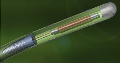 A catheter with an electromagnetic sensor.