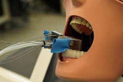 Low Res 01 Dental Robot University Of Basel