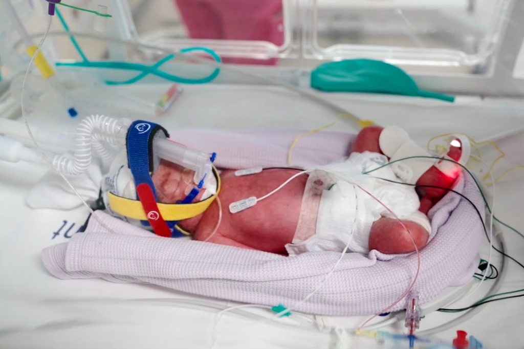 In this image taken from video taken on July 15, 2026, one of the quadruplets born at Metro North Health hospital lies in an incubator in Brisbane, Australia.