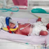 In this image taken from video taken on July 15, 2026, one of the quadruplets born at Metro North Health hospital lies in an incubator in Brisbane, Australia.