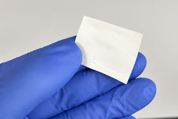 Close Up Of The Bio Based Janus Nanofibre Membrane Developed For Antibacterial Wound Care
