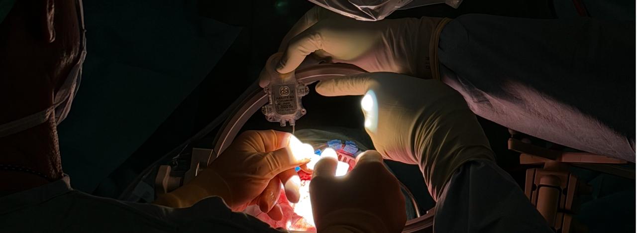 Fih Intraop